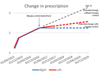 Rian-graph-cl-change-resize