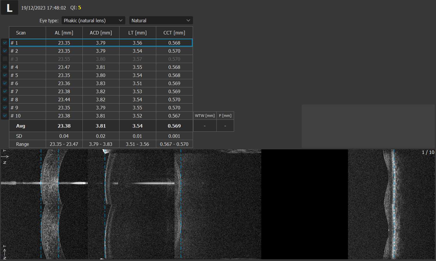 Axial length and accurate measurement of the structure of the eye for myopia management